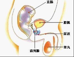 急性急性前列腺痛