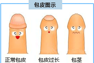 包皮过长为什么要手术