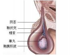 如何摆脱睾丸鞘膜积液的伤害呢?